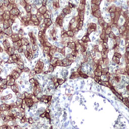 Cytokeratin 18 antibody - VetSignal (GTX134973)