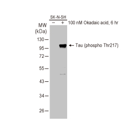 Tau (phospho-Thr217) antibody [HL1276] (GTX636678)