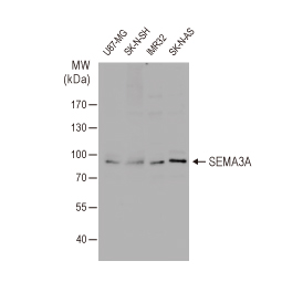 Semaphorin 3A antibody 