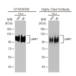 LAMP1 antibody [GT25212] (GTX634336)