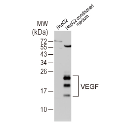 VEGF antibody (GTX102643)