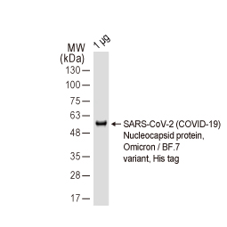 SARS-CoV-2 (COVID-19) Spike RBD antibody [HL1014] (GTX635807)