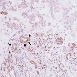 VCAM1 / CD106 antibody [N1N2], N-term (GTX110684)