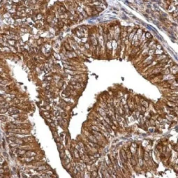 MMP2 antibody (GTX104577) 