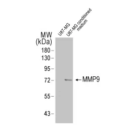 MMP9 antibody [N2C1], Internal (GTX100458)
