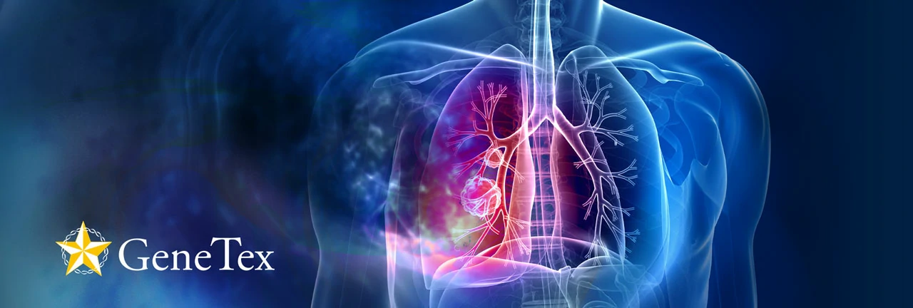 Article Alert: The CXCL14/ACKR2 Axis Drives Lung Cancer Metastasis