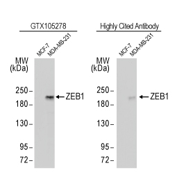 ZEB1 antibody [N2C1], Internal (GTX105278)