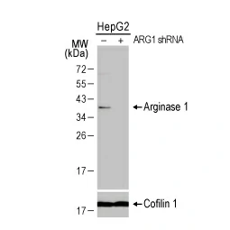 Arginase 1 antibody (GTX109242)