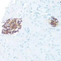 ODC antibody (GTX54600)