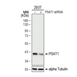 PSAT1 antibody [GT1353] (GTX633629)