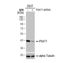 PSAT1 antibody [HL2270] (GTX638322)