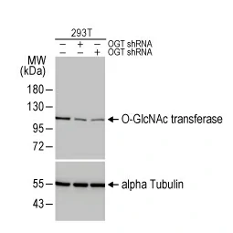O-GlcNAc transferase antibody [HL1641] (GTX637222)