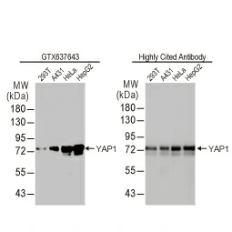 YAP1 antibody [HL1894] (GTX637643)