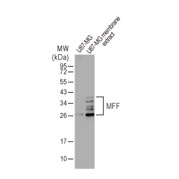 MFF antibody [HL1311] (GTX636729)