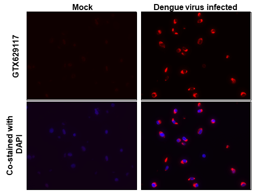 denguevirusenvelopeprotein抗体gt643