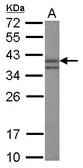 Anti-Nanog antibody [N3C3] used in Western Blot (WB). GTX100863
