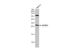 Anti-EIF4E2 antibody [N1C3] used in Western Blot (WB). GTX103977