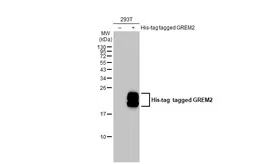 Anti-GREM2 antibody [C1C3] used in Western Blot (WB). GTX108414