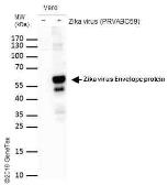 zika virus envelope protein抗体