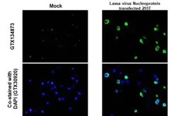 Anti-Lassa virus Nucleoprotein antibody used in IHC-P (cell pellet) (IHC-P (cell pellet)). GTX134873
