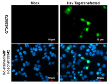 Anti-HSV tag antibody [GT223] used in Immunocytochemistry/ Immunofluorescence (ICC/IF). GTX629073