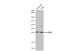 Anti-eIF4E antibody [HL1554] used in Western Blot (WB). GTX637029