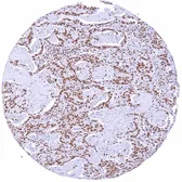 Anti-CBP antibody [HMV319] HistoMAX&trade; used in IHC (Paraffin sections) (IHC-P). GTX639943