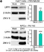 zika virus envelope protein抗体