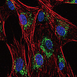 CD63 antibody [MEM-259]