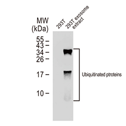 Ubiquitin antibody [GT7811]