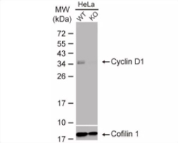 Cyclin D1 antibody [N1C3] (GTX108624)
