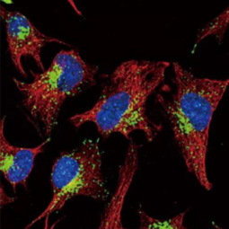 LAMP1 antibody [GT25212] (GTX634336)