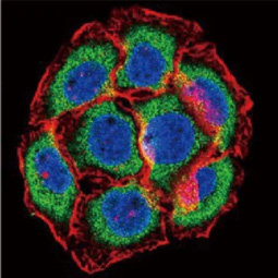 PSMB6 antibody (GTX23331)