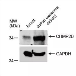 CHMP2B antibody (GTX118181)