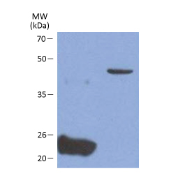 Glypican 4 antibody [AT51E3] (GTX16498)