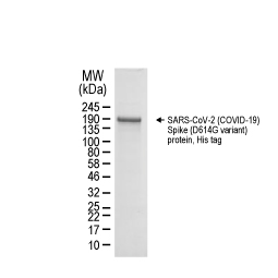 SARS-CoV-2 (COVID-19) Spike (D614G variant) protein, His tag (GTX02575-pro)