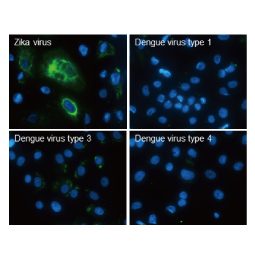 Zika virus Capsid protein antibody (GTX133317)