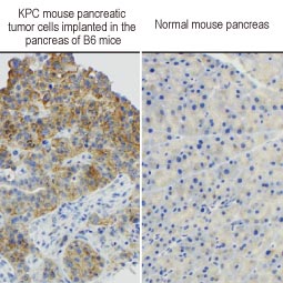 RAS (G12D Mutant) antibody [HL10] (GTX635362)