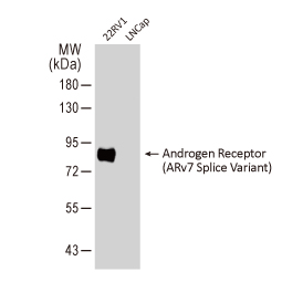 Androgen Receptor (AR-V7 Splice Variant) antibody [HL1028] (GTX635842)