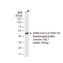 SARS-CoV-2 (COVID-19) Nucleocapsid protein, Omicron / BQ.1 variant, His tag (GTX137883-pro)