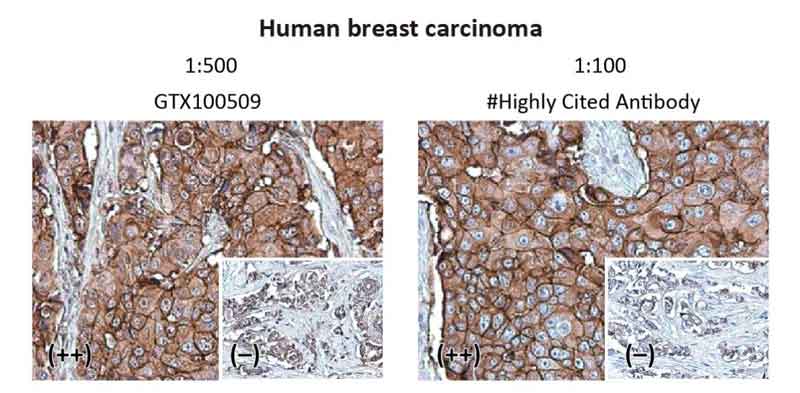 Her2 / ErbB2 antibody (GTX100509)