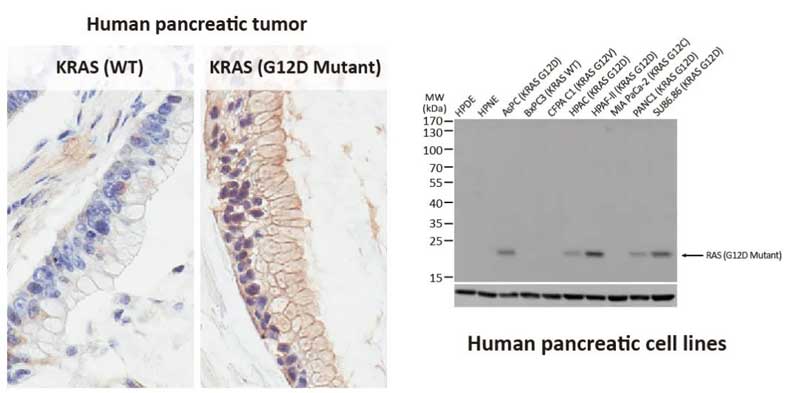 RAS (G12D Mutant) antibody [HL10] (GTX635362)