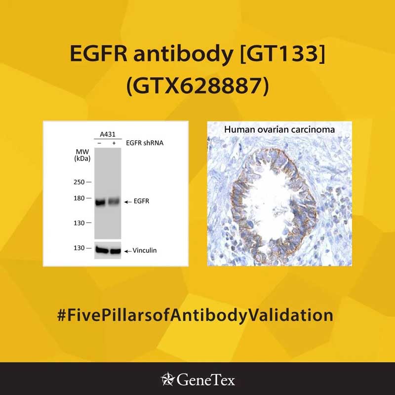 EGFR antibody [GT133] (GTX628887)