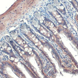 Integrin beta 1 / CD29 antibody [HL1255] (GTX636657)