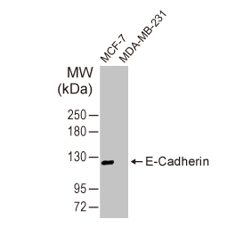 E-Cadherin antibody [HL1228] (GTX636576)