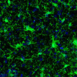 Iba1 antibody [HL22] (GTX635363)