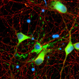 Myelin basic protein antibody [HL1033] (GTX635873)