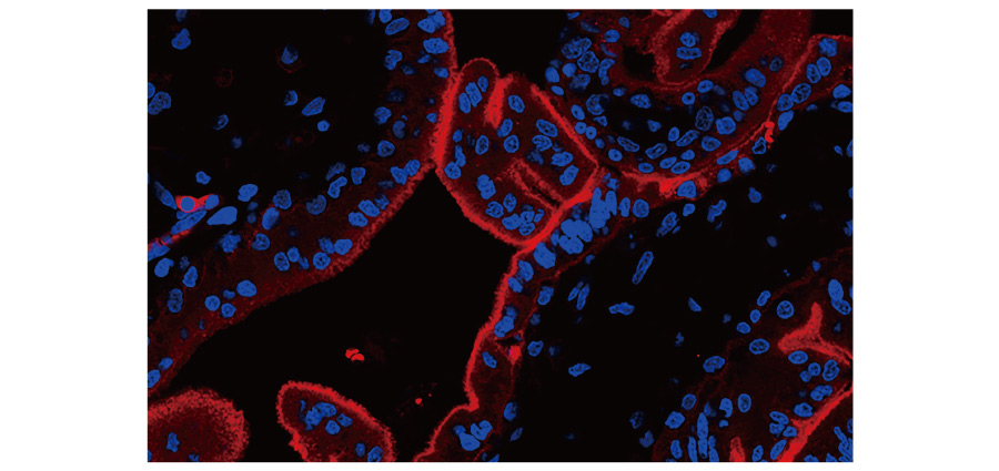 PD-L1 antibody [HL1041]