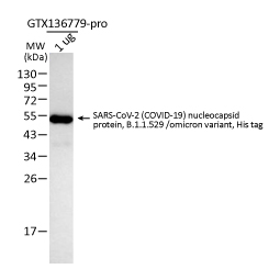 SARS-CoV-2 (COVID-19) nucleocapsid protein, B.1.1.529 / Omicron variant, His tag