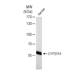CYP27A1 antibody (GTX103718)